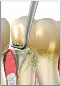 ORAQIX Clinical Application Step 3